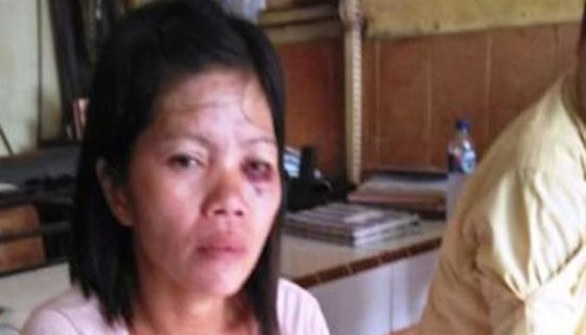 istri dianiaya suami