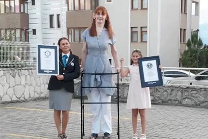 Ini Wanita Tertinggi di Dunia, Tinggi Lebih dari 2 Meter