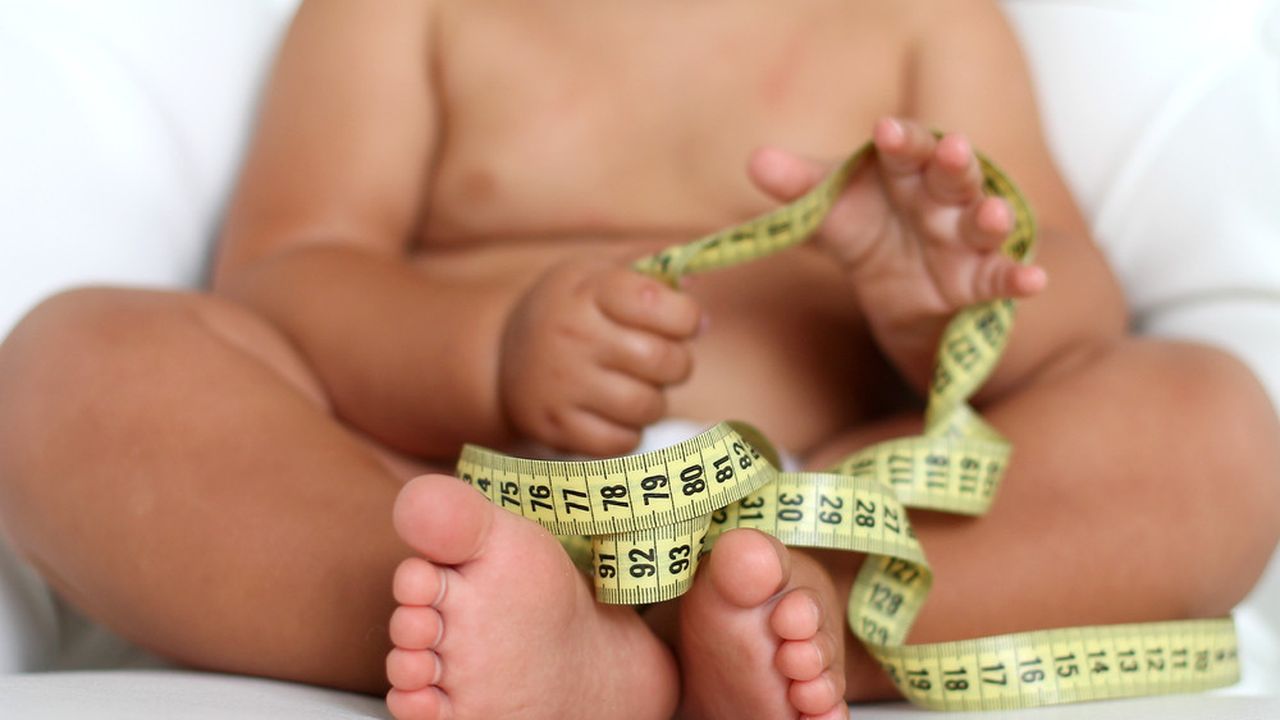 bayi obesitas