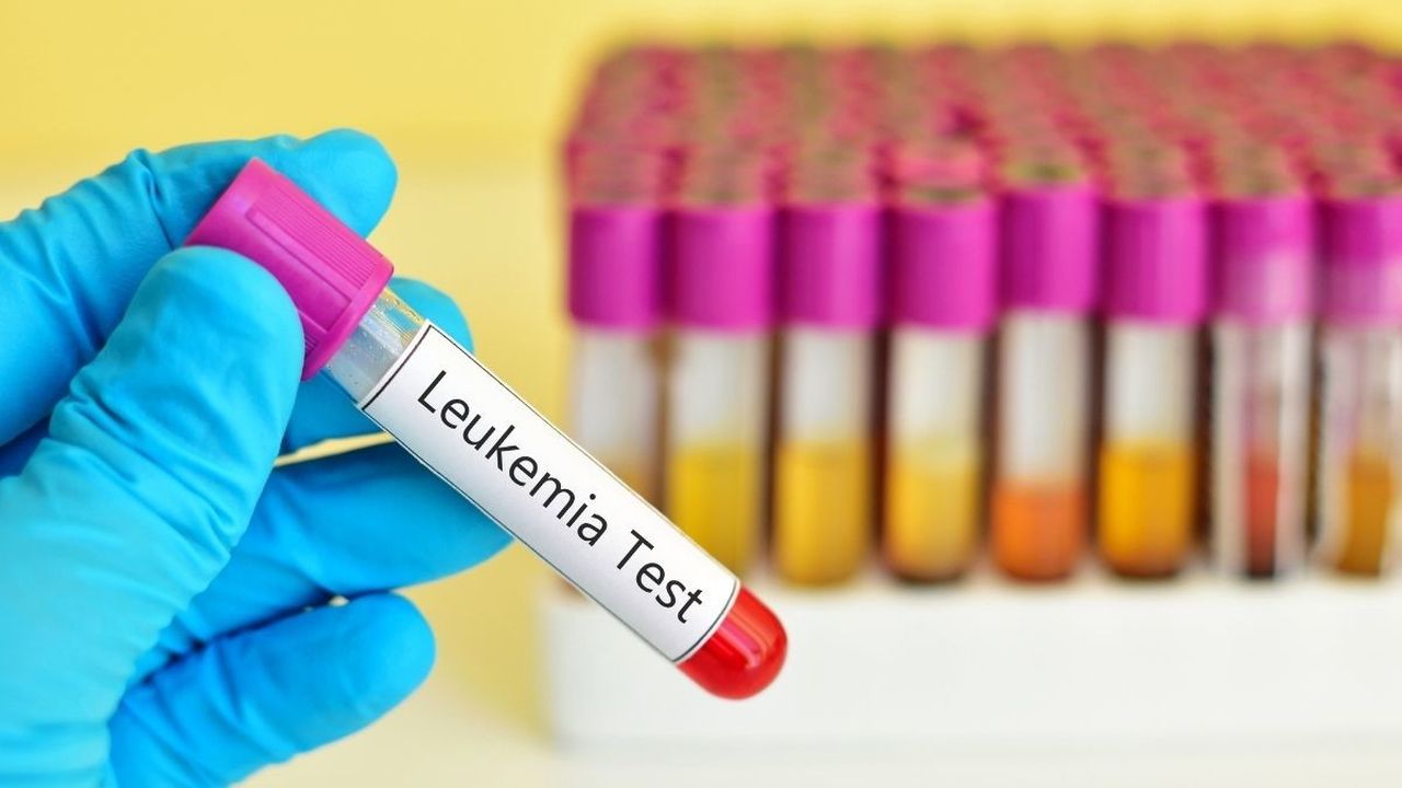 test leukemia