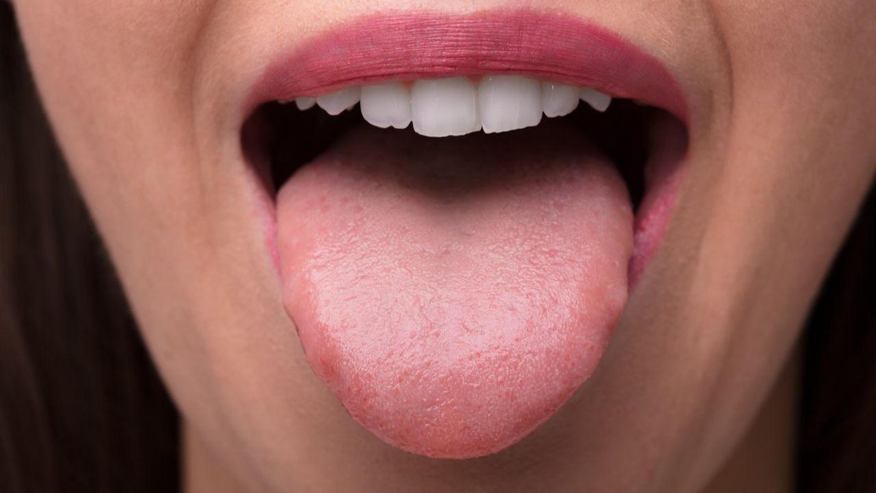 penyebab lidah pahit