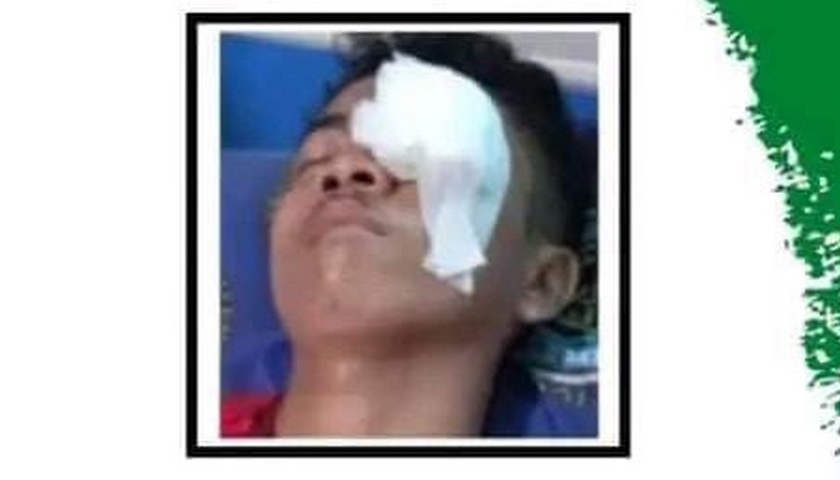 Seorang mahasiswa asal Aceh Singkil yang melanjutkan kuliahnya di Lhokseumawe inisial AH ditembak OTK. Penembakan terjadi saat sedang berlangsung rapat dengan seluruh mahasiswa Aceh Singkil yang kuliah di kota tersebut.