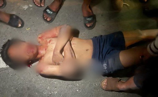 Seorang remaja berusia 16 tahun warga Jalan SM Raja, Kecamatan Medan Amplas, tergeletak berlumur darah. Kuat dugaan, korban tergeletak akibat tawuran.