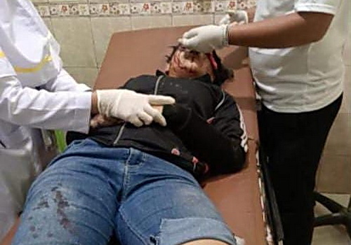 Seorang wanita berinisial A di Binjai, menjadi korban kebiadapan begal dan mengalami luka cukup parah usai disabet golok kendati sepeda motornya gagal dirampas.