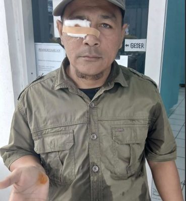 Salah satu dari 5 orang terluka setelah terjadi bentrokan antara ratusan masyarakat yang tergabung dalam Himpunan Kerukunan Tani Indonesia (HKTI) Asahan dengan puluhan Satpam PT BSP Kisaran, Kamis (13/8).