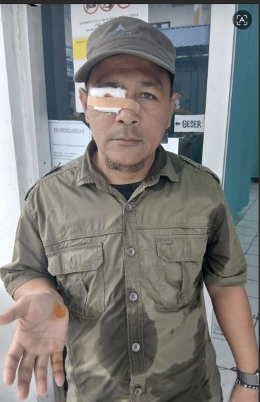 Salah satu dari 5 orang terluka setelah terjadi bentrokan antara ratusan masyarakat yang tergabung dalam Himpunan Kerukunan Tani Indonesia (HKTI) Asahan dengan puluhan Satpam PT BSP Kisaran, Kamis (13/8).